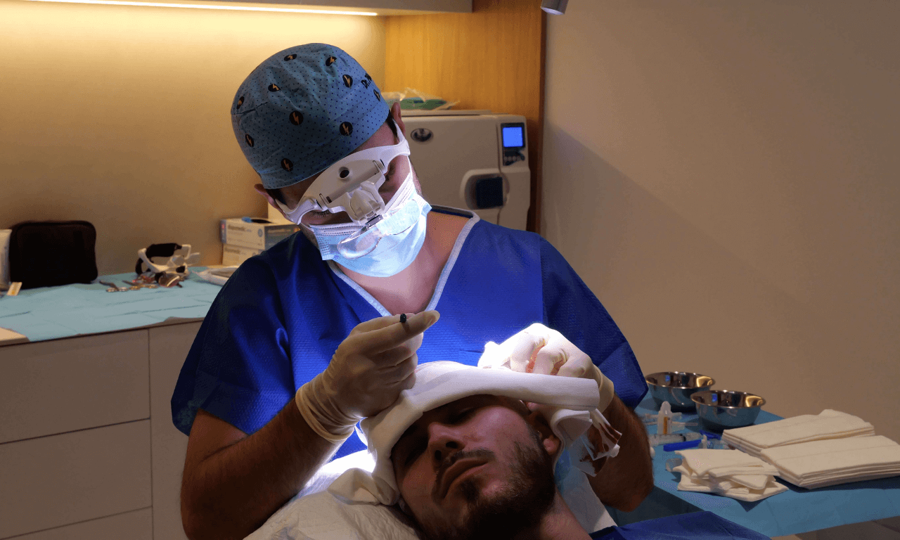 Extracción de folículos