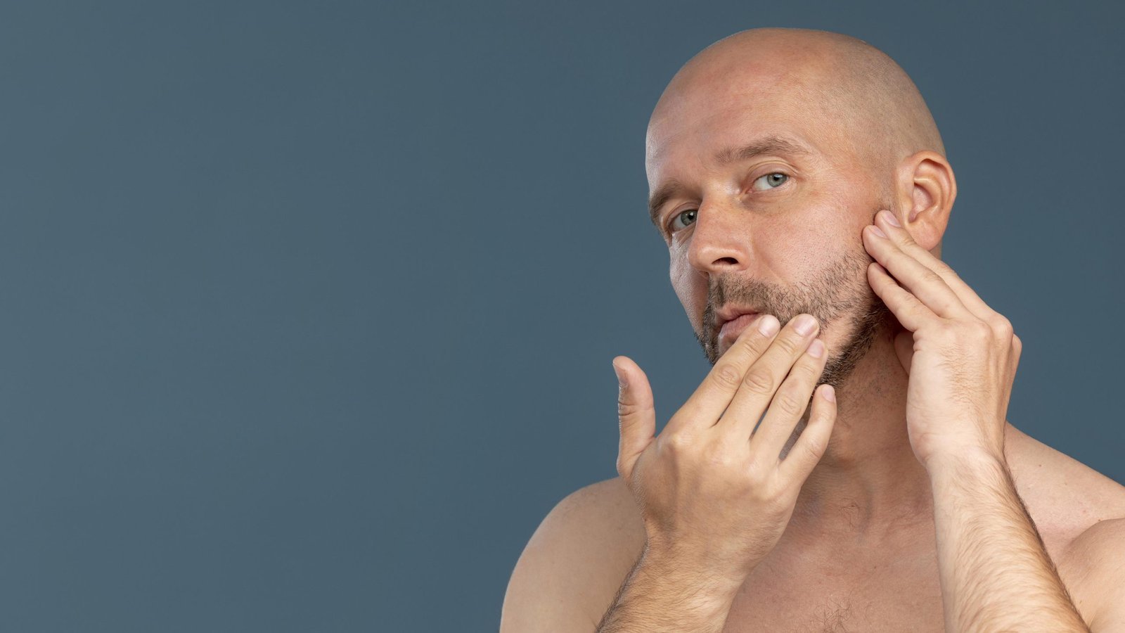 alopecia areata en la barba